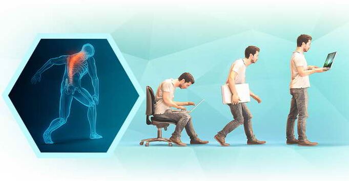 mauvaise posture lorsque l'on travaille sur un ordinateur et ostéochondrose thoracique