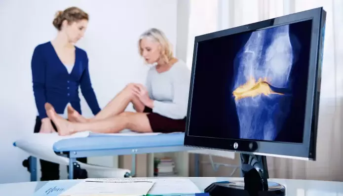 arthrose de l'articulation chez une femme.